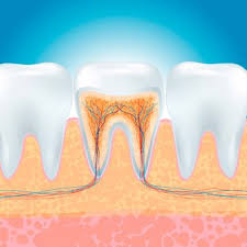 Root Canal Treatment Cost in Bhopal